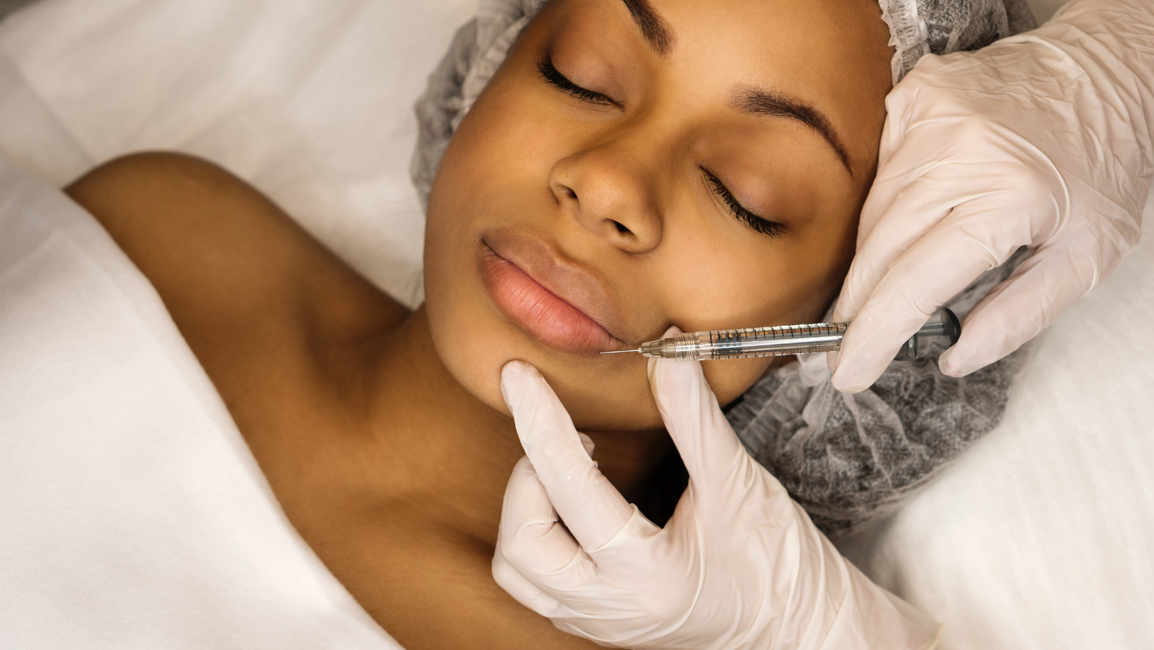 dermal-fillers-burton